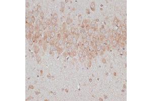 Immunohistochemistry of paraffin-embedded rat brain using TMX1 antibody  at dilution of 1:100 (40x lens). (TMX1 antibody  (AA 210-280))