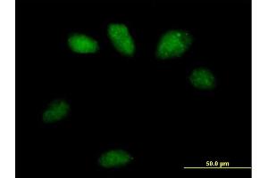 Immunofluorescence of purified MaxPab antibody to GSTO2 on HeLa cell. (GSTO2 antibody  (AA 1-243))