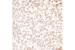 Immunohistochemistry (IHC) image for anti-H2A Histone Family, Member X (H2AFX) (C-Term) antibody (ABIN7453533) (H2AFX antibody  (C-Term))