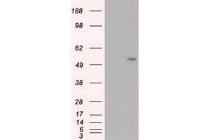 Image no. 7 for anti-Myc Proto-Oncogene protein (MYC) antibody (ABIN1497012) (c-MYC antibody)