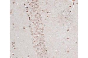 Immunohistochemistry of paraffin-embedded Mouse brain using ZNF177 Polyclonal Antibody at dilution of 1:100 (40x lens).