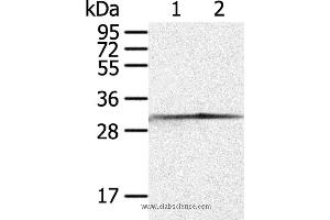Western blot analysis of Jurkat and 293T cell, using CASP3 Polyclonal Antibody at dilution of 1:300 (Caspase 3 antibody)