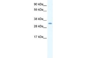 Western Blot showing PDLIM1 antibody used at a concentration of 1-2 ug/ml to detect its target protein.