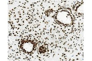 IHC analysis of KAP1/TRIM28 using anti-KAP1/TRIM28 antibody (ABIN7602311).