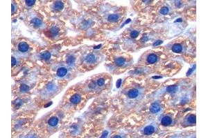 IHC-P analysis of Rat Liver Tissue, with DAB staining. (FTH1 antibody  (AA 1-182))
