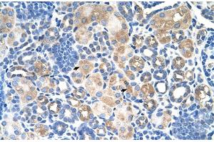 Human kidney (SLC38A1 antibody  (Middle Region))