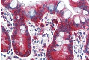 Human Small Intestine (formalin-fixed, paraffin-embedded) stained with TPD52L1 antibody ABIN364314 at 5 ug/ml followed by biotinylated anti-mouse IgG secondary antibody ABIN481714, alkaline phosphatase-streptavidin and chromogen. (TPD52L1 antibody)