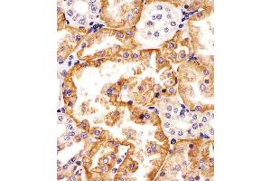 (ABIN6242877 and ABIN6578324) staining SLC22A2 in human kidney tissue sections by Immunohistochemistry (IHC-P - paraformaldehyde-fixed, paraffin-embedded sections).