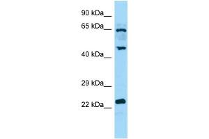 WB Suggested Anti-DUSP14 Antibody Titration: 1. (DUSP14 antibody  (C-Term))