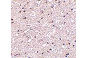Immunohistochemistry of HAP1 in human brain tissue with HAP1 antibody at 2. (HAP1 antibody  (Center))