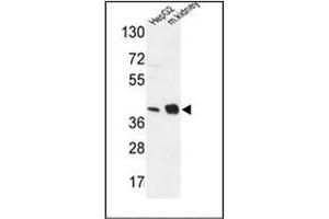 Western blot analysis of NDUFA10 Antibody (Center) in HepG2 cell line and mouse kidney tissue lysates (35ug/lane). (NDUFA10 antibody  (Middle Region))