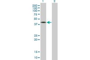 Lane 1: FOSL2 transfected lysate ( 35. (FOSL2 293T Cell Transient Overexpression Lysate(Denatured))