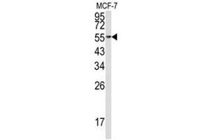 Image no. 1 for anti-Eukaryotic Translation Elongation Factor 1 alpha 1 (EEF1A1) (C-Term) antibody (ABIN452935) (eEF1A1 antibody  (C-Term))