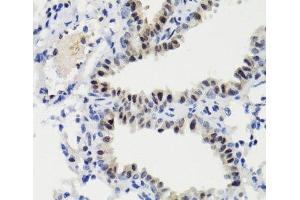 Immunohistochemistry of paraffin-embedded Mouse lung using Phospho-Stat3(S727) Polyclonal Antibody at dilution of 1:100 (40x lens). (STAT3 antibody  (pSer727))