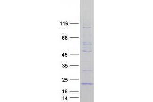 Validation with Western Blot