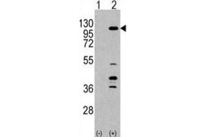 Western Blotting (WB) image for anti-Phosphoinositide-3-Kinase, Catalytic, gamma Polypeptide (PIK3CG) antibody (ABIN3003740) (PIK3 gamma antibody)