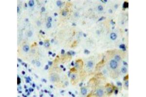Used in DAB staining on fromalin fixed paraffin-embedded Liver tissue (FURIN antibody  (AA 587-748))