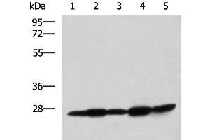 Western blot analysis of Mouse liver tissue Mouse brain tissue Rat brain tissue Rat liver tissue and Human fetal liver tissue lysates using QDPR Polyclonal Antibody at dilution of 1:800 (QDPR antibody)