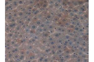 Figure. (CYR61 antibody  (AA 176-379))