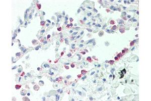 Anti-CYP2B6 antibody IHC staining of human lung. (CYP2B6 antibody  (AA 235-263))