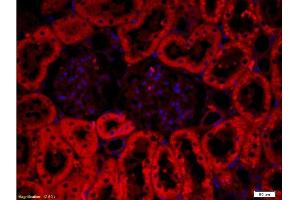 Formalin-fixed and paraffin embedded: rat kidney tissue labeled with Anti-CRF/CRH Polyclonal Antibody , Unconjugated at 1:200, followed by conjugation to the secondary antibody was Goat Anti-Rabbit IgG, PE conjugated -PE) at 1:200 for 40 minutes at 37°C DAPI(5ug/ml, blue) was used to stain the cell nuclei (CRH antibody  (AA 145-185))