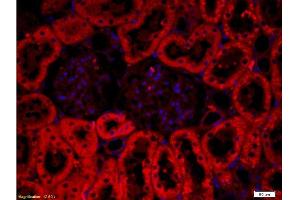 Formalin-fixed and paraffin embedded: rat kidney tissue labeled with Anti-CRF/CRH Polyclonal Antibody , Unconjugated at 1:200, followed by conjugation to the secondary antibody was Goat Anti-Rabbit IgG, PE conjugated -PE) at 1:200 for 40 minutes at 37°C DAPI(5ug/ml, blue) was used to stain the cell nuclei (CRH antibody  (AA 145-185))