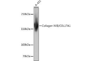 Western blot analysis of extracts of A-431 cells, using Collagen XVII/COL17 Rabbit mAb (ABIN7266467) at 1:1000 dilution. (COL17A1 antibody)