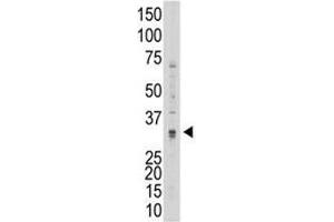 Western blot testing of MMP7 antibody and 293 cell lysate (MMP7 antibody  (AA 117-146))