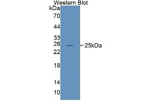 Figure. (ABCA8 antibody  (AA 1263-1456))