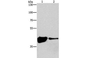 Western Blot analysis of 293T and Human fetal brain tissue using MAPK11 Polyclonal Antibody at dilution of 1:200 (MAPK11 antibody)
