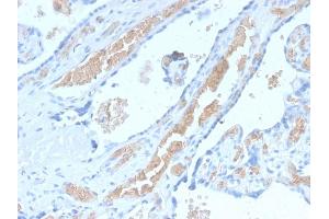 Formalin-fixed, paraffin-embedded human Pancreas stained with Spectrin alpha 1 Rabbit Recombinant Monoclonal Antibody (SPTA1/2939R). (Recombinant SPTA1 antibody  (AA 356-475))