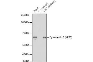 Immunoprecipitation (IP) image for anti-Keratin 5 (KRT5) antibody (ABIN3016405)
