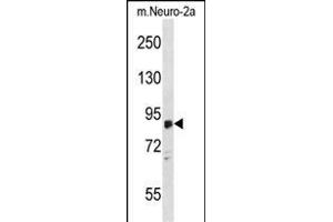 ZDHHC8 Antibody (C-term) (ABIN1537445 and ABIN2848468) western blot analysis in mouse Neuro-2a cell line lysates (35 μg/lane). (ZDHHC8 antibody  (C-Term))