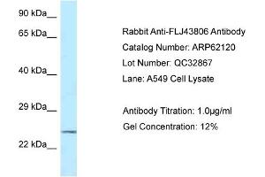 Western Blotting (WB) image for anti-Kazrin (KAZ) (C-Term) antibody (ABIN2774334)