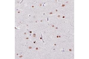 Immunohistochemical staining (Formalin-fixed paraffin-embedded sections) of human cerebral cortex with ZEB1 monoclonal antibody, clone CL0151  shows moderate to strong nuclear immunoreactivity in neuronal and glial cells.