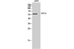 Western Blotting (WB) image for anti-Tripartite Motif Containing 38 (TRIM38) (Internal Region) antibody (ABIN3186824) (TRIM38 antibody  (Internal Region))