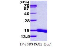 Ubiquitin-Conjugating Enzyme E2D 4 (UBE2D4) (AA 1-147) protein (His tag)