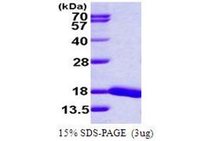 SDS-PAGE (SDS) image for Ubiquitin-Conjugating Enzyme E2D 4 (UBE2D4) (AA 1-147) protein (His tag) (ABIN667583) (UBE2D4 Protein (AA 1-147) (His tag))