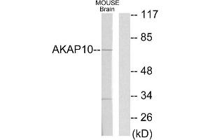 Western blot analysis of extracts from mouse brain cells, using AKAP10 antibody. (AKAP10 antibody  (N-Term))
