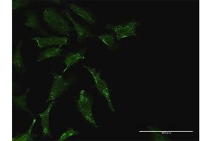 Immunofluorescence of purified MaxPab antibody to TEX264 on HeLa cell. (TEX264 antibody  (AA 1-313))