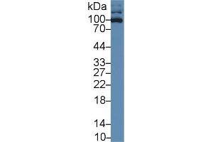 Western blot analysis of Human HL60 cell lysate, using Rabbit Anti-Human ICAM3 Antibody (1 µg/ml) and HRP-conjugated Goat Anti-Rabbit antibody (abx400043, 0. (ICAM-3/CD50 antibody  (AA 46-197))