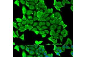 Immunofluorescence analysis of U2OS cells using MYH1 Polyclonal Antibody (MYH1 antibody)
