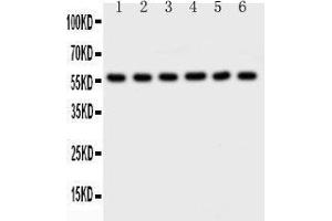 Observed bind size: 56KD (AKT2 antibody  (C-Term))