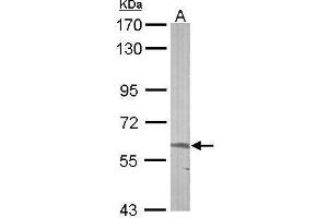 WB Image Sample (50 ug of whole cell lysate) A: mouse liver 7. (ALAS2 antibody  (Center))