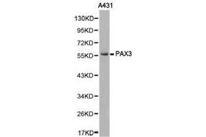 Western Blotting (WB) image for anti-Paired Box 3 (PAX3) antibody (ABIN1874047) (Paired Box 3 antibody)