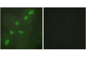 Immunofluorescence analysis of HeLa cells, using hnRNP A2/B1 Antibody.