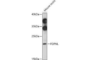 Western blot analysis of extracts of Mouse testis, using FOPNL antibody (ABIN7267173) at 1:1000 dilution. (FOPNL antibody  (AA 20-100))