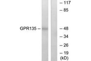 Western blot analysis of extracts from NIH-3T3 cells, using GPR135 Antibody. (GPR135 antibody  (AA 371-420))
