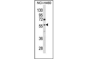Western blot analysis of GBRR3 Antibody (N-term) in NCI-H460 cell line lysates (35ug/lane). (GBRR3 antibody  (N-Term))