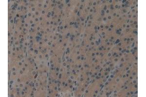 Immunohistochemistry (IHC) image for anti-Eukaryotic Translation Initiation Factor 2-alpha Kinase 2 (EIF2AK2) (AA 279-506) antibody (ABIN1860247)